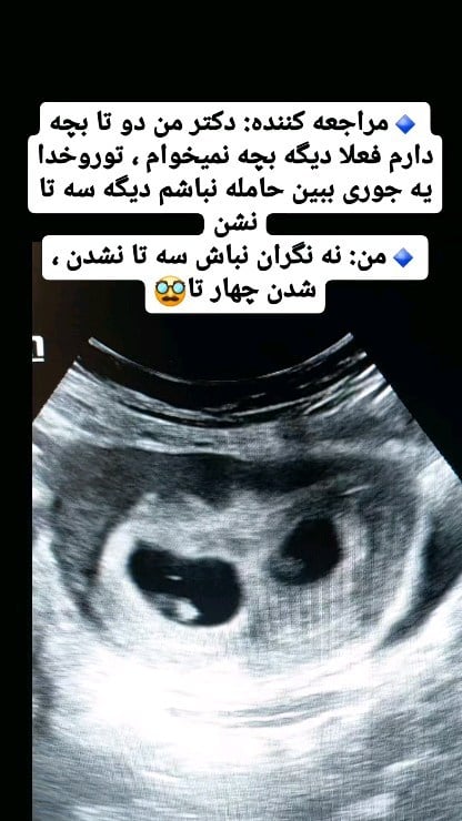 .این دیالوگ من و یکی از مریضام بود و بعد این که گفتم چهار تا شدن اولش متوجه نشد چی بود منظورم و خندید ، بعد یکم فکر کرد و گفت یعنی چی؟ واسش توضیح دادم که چه خبره و بعدش ناراحت شد ولی بعدش دوباره خندید و رفت بیرون #دوقلو #چندقلو #حاملگی #تولد #دکترنوری