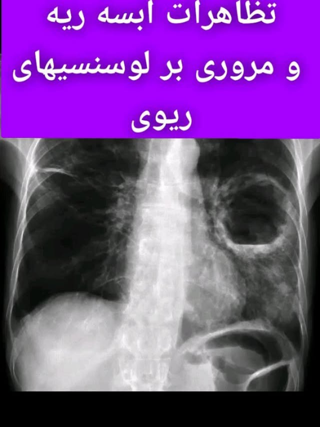 توضیحات کیس قبلی