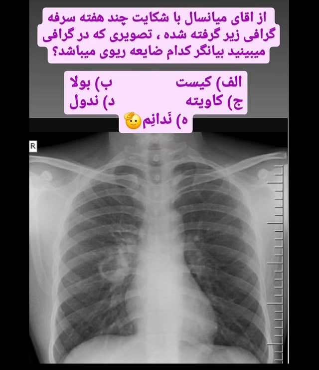 گزینه ای که به نظرتون درست هست رو کامنت کنید، تو پست بعدی ایشالا توضیحاتشو خواهم گفت