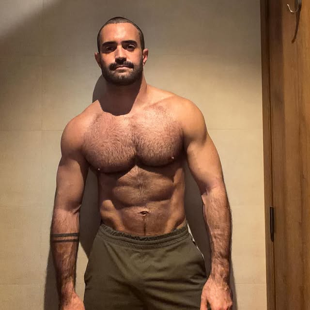 Criminal 🤣🤣 my first photo after the hair implant - by @xavier.rodrigo.x