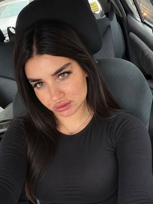 sometimes your skin can look bad and that’s okaysometimes make up it’s not enough to cover up your insecurities and that’s okay feeling beautiful starts from insideperfection it’s not realand we should not be embarrassed of how we look we are humans and if someone judge you for your looks fuck them !!!!! ❤️‍🩹 by @lavinianadinetamas_