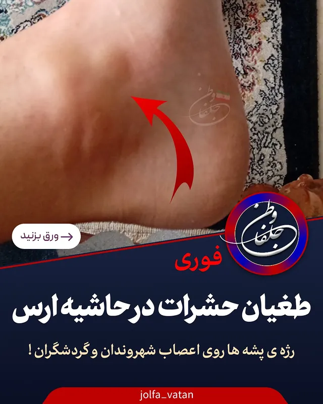 طغـ.ـیان حشرات در حاشیه ارس رژه ی پشه ها روی اعصـ.ـاب شهروندان و گردشگراناقـ.ـدامات کنترلی و پیشگیرانه :برای مقابله با این پدیده‌ها و حفظ سلامت شهروندان و گردشگران، اقدامات زیر در منطقه انجام می‌شود:طرح‌های لاروکشـ.ـی بیولوژیک: سازمان منطقه آزاد ارس هرساله طرح‌های ویژه‌ای برای کنترل بیولوژیک حشرات و نابودی لاروها به جای استفاده از سمــ.ــوم شیمـ.ـیایی مضـ.ـر اجرا می‌کند. کنترل پشه‌های مـــ...ـهاجم: با توجه به احتمال شیـ.ـوع بیمـ.ـاری‌هایی نظیر تب دنگی، قرارگاه‌های پـ.ـ.دافند غیرعامـ.ـل زیستی در شهرستان‌هایی مانند جلفا اقدام به پایش مداوم و آموزش راه‌های پیشگیری از گـ.ـزش به شهروندان کرده‌اند. عقیـ.ـ.م‌سازی حشرات: تجربه موفق عقیـ.ـم‌سازی پشه‌ها با روش‌های پرتودهی و رهـ.ـاسازی آن‌ها در طبیعت، از جمله راهکـ.ـارهایی است که برای کنترل جمعیت این حشرات در منطقه آزاد ارس به کـ.ـار گرفته می‌شود. گویا امسال خبری از اقدامات فوق نیست ! اگر هست این همه پیام مخاطبان چیست؟!مسئولین مربوطه لطفا رسیدگی کنید#جلفا#پشه#رود_ارس#خبرفوری #اخبار_جلفا
