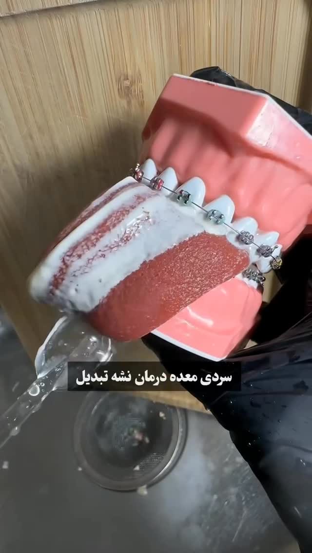 سردی معده میتونه تبدیل به سردی مغز بشه🧠
.
#سردی #طب_سنتی #بیماری